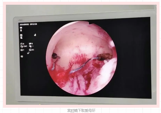 微信图片_2025-06-19_091635_693.png